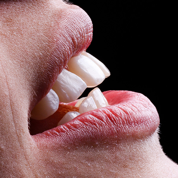 Tratamento de estética dental na clínica Dr. Maurilio Filho em Taiúva